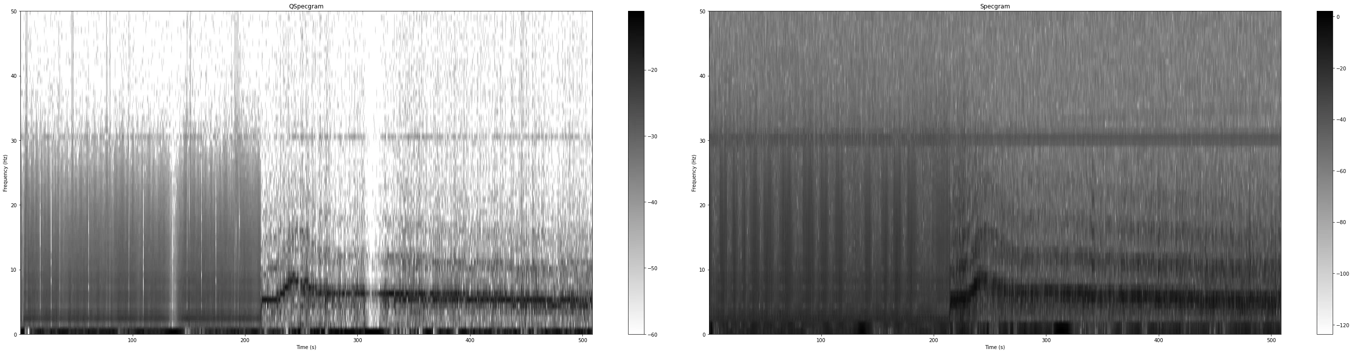 First ever Quantum Cardiac Anomaly Spectrogram